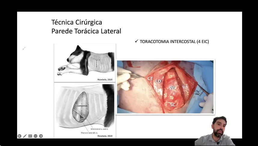 Cirurgias Cardiotorácicas